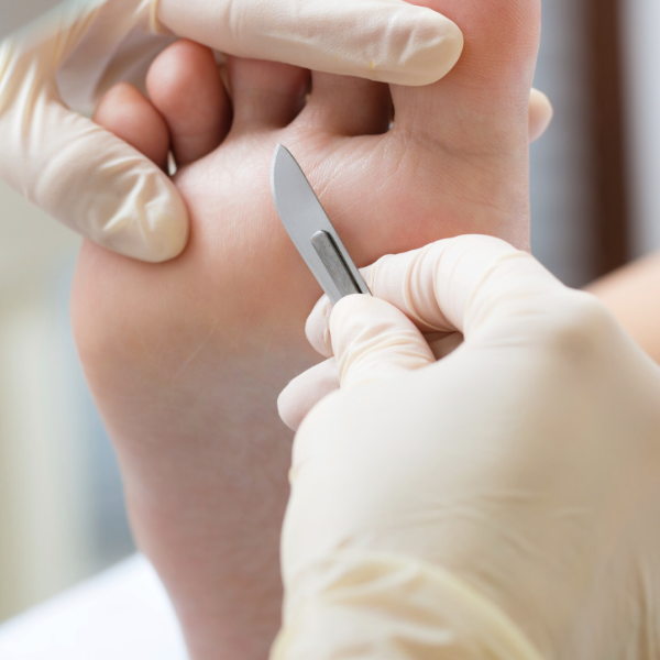 The Perception of Podiatry